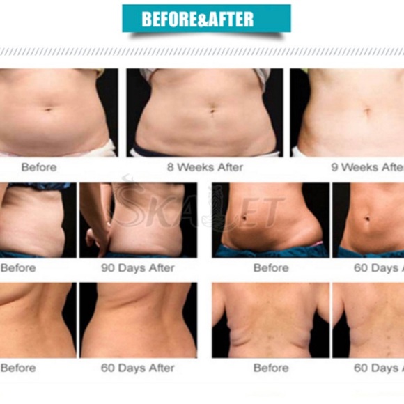 3 in 1 Ultrasonic 40K Cavitation Body Slimming Machine - Brand New - Picture 7 of 7